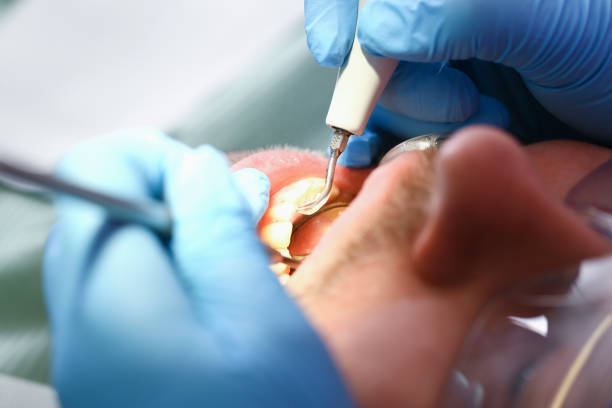 Best Broken or Cracked Tooth Emergency Dentist in Luverne, AL